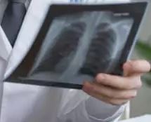 Lungenröntgen