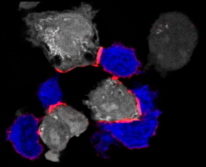 Immunfluoreszenzmikroskopie_T-Zellen_blau_greifen Krebszellen_grau_an_Uni-Basel_2022
